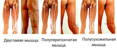 Искусственный коленный сустав - в клинике Линько