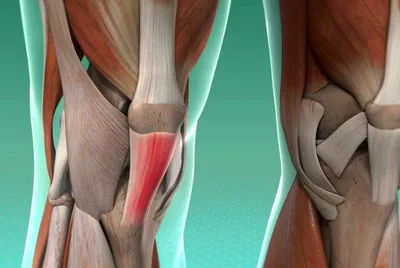 Коленный сустав (МРТ): атлас лучевой анатомии человека | e-Anatomy