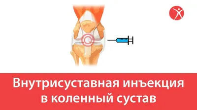 Бандаж (тутор) на коленный сустав Алком 3013