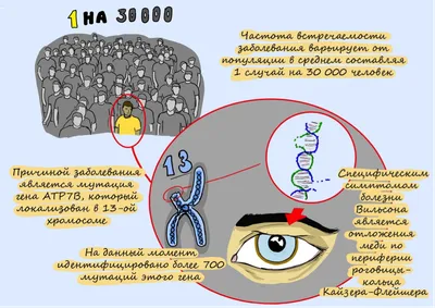 Красивые глаза\" как симптом болезни. | Пикабу