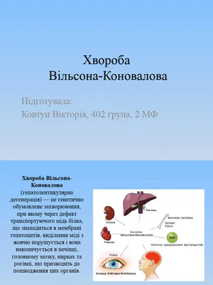 Сложный пациент: болезнь Вильсона–Коновалова