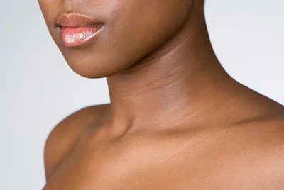Кольца венеры на шее: как убрать, избавиться, советы экспертов, отзывы |  Beauty Insider