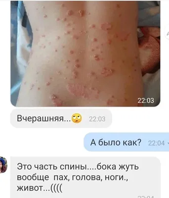 КОЛЬЦЕВИДНАЯ... - Клиника педиатрии Доктора Трухманова | Facebook