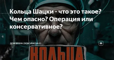 Кольцо Шацкого. Пищевод баретта | Записки врача-эндоскописта | Дзен