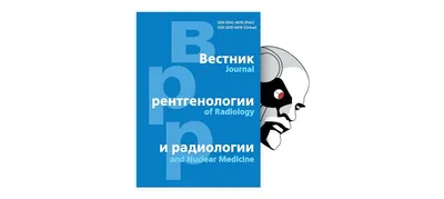 Кольцо Шацкого – причины формирования, симптомы и лечение сужения нижней  части пищевода | athletic-store.ru