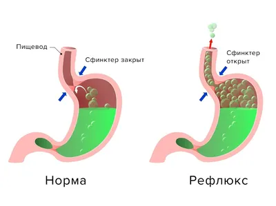 Белый рояль\" (СССР, 1969) и \"Теща\" (СССР, 1974): разные мнения | ИСТОРИЯ  КИНО | Дзен