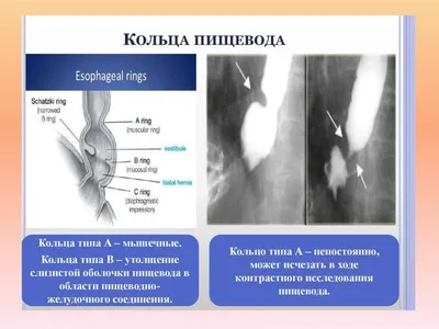 Нина Шацкая в украшениях Mercury на страницах «Атмосферы» | Mercury