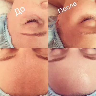 Как определить тип кожи лица: 3 способа + онлайн-тест La Roche‑Posay