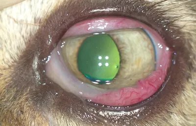 Диффузное прокрашивание бульбарной конъюнктивы лиссаминовым зелёным.  Признак синдрома сухого глаза ( в норме конъюнктива не… | Instagram