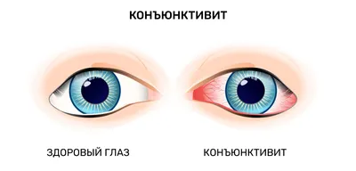 Болезни глаза у человека – список глазных болезней, их описание, симптомы и  лечение