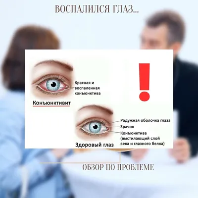 Сухой глаз Диагностика | Школа офтальмологии