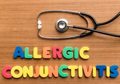 Конъюнктивит: причины, симптомы, лечение, у ребенка, аллергический –  Стоматология в Бирюлево
