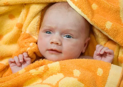 Конъюнктивит у ребенка в 9 месяцев - энциклопедия Ochkov.net