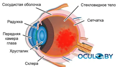 Офтальмолог Москва on Instagram: \"Боль в глазу Боль в глазу - это  неприятное ощущение, которое возникает при разных повреждениях/патологиях  глаза. Причины могут быть разными: 1) ожог глаза Ожог, независимо от того,  химический