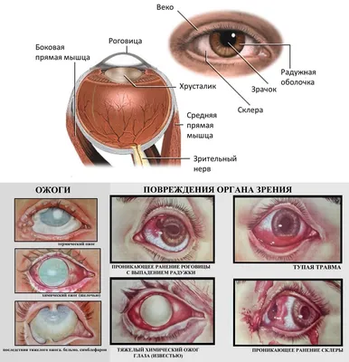 Оказание первой помощи при травмах глаз: основные правила
