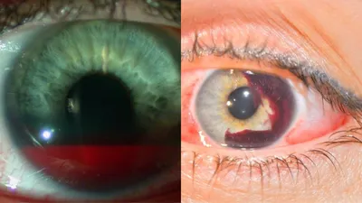 Есть ли шансы восстановить зрение после травмы