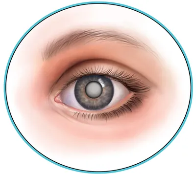 Травмы глаза - презентация онлайн