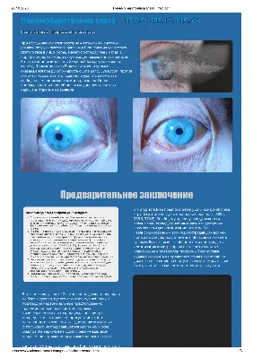 Тюменские офтальмологи отмечают увеличение экстренных пациентов с  повреждениями глаз | 02.05.2023 | Тюмень - БезФормата