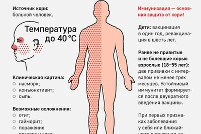 Эпидситуация по кори: не доводить до осложнений, подчищать и наверстывать -  Индустриальная Караганда