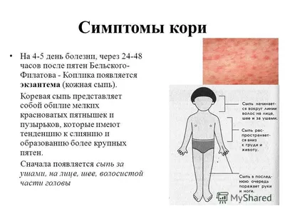 Как своевременно выявить корь у ребенка — Человек и Закон