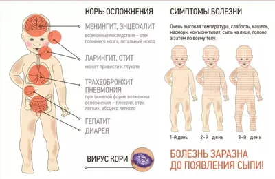 Корь - что это, как выглядит, причины, симптомы и лечение