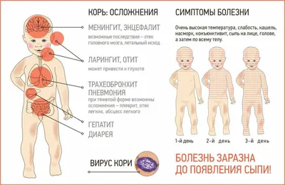 Корь: диагностика, лечение, профилактика - Областная клиническая  наркологическая больница