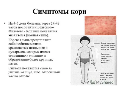 В Украине новая вспышка кори: симптомы, лечение и профилактика заболевания  | Українські Новини