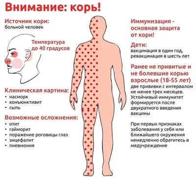 Корь у детей: симптомы, признаки, как проявляется начальная стадия, лечение  и профилактика