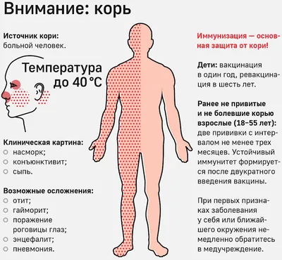 Корь может к нам вернуться