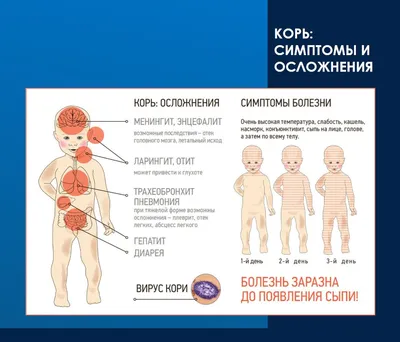 Врач перечислил основные симптомы кори: Общество: Россия: Lenta.ru