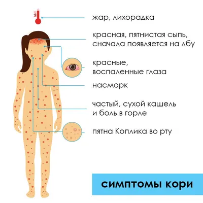 Корь возвращается | Оренбургский областной центр общественного здоровья и  медицинской профилактики