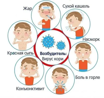 Москва KG - 📌Первые признаки кори. Сохраните, чтобы не... | Facebook