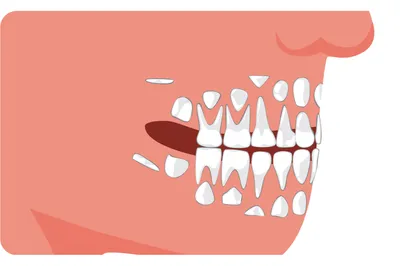 Чем молочные зубы отличаются от постоянных