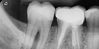 Зачем нужны молочные зубы - до какого возраста они растут