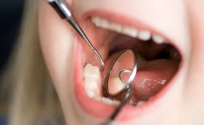 Строение зуба человека