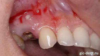 Чем молочные зубы отличаются от постоянных