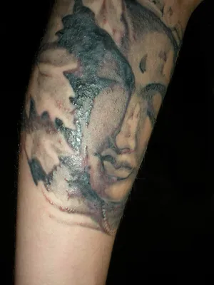 Удаление татуировки лазером | Доктор Марина Гогина