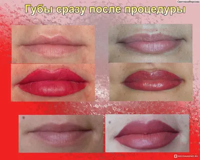 Татуаж Туапсе - 👄Сексуальность на виду...👄 ⠀ 💄Это я про губы которые  всегда выражают женскую сексуальность🥰 ⠀ 🍭Процесс заживления  перманентного макияжа губ ⠀ 💫Процедура перманентного макияжа(татуажа)  сложный процесс. ⠀ 📢 Собираясь на