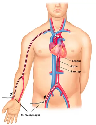 Анатомия: Кровоснабжение сердца. Питание сердца. Венечные артерии сердца