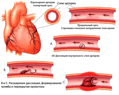 Артерия — Википедия