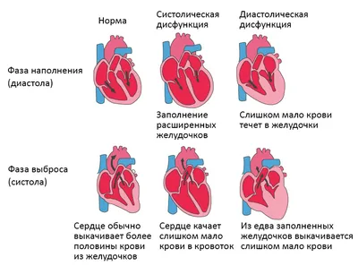 Аортокоронарное шунтирование