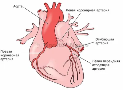 Коронарография