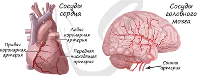 УЗИ сердца и сосудов шеи - для чего делать и что показывает