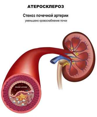 3d модель сердца, изображение коронарной артерии, лекарственное средство,  артерия фон картинки и Фото для бесплатной загрузки