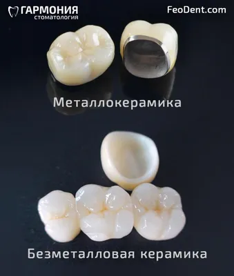 Циркониевая коронка на зуб в городе Раменское - «New Smile»