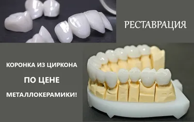 Зубные коронки из диоксида циркония для имплантации и протезирования зубов  | Mednavigator.ru | Дзен