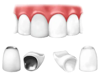 Циркониевые коронки | СК доктора Афанасьевой
