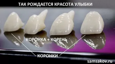 Какие зубные коронки самые лучшие и долговечные? 🦷 iStomatolog, Киев