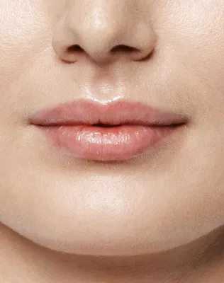 Контурная пластика губ в Тюмени, увеличение губ филлерами гиалуроновой  кислотой | Авторская клиника