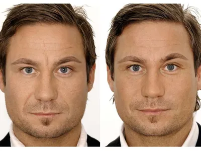 Бьютификация лица. До и После (Фото)